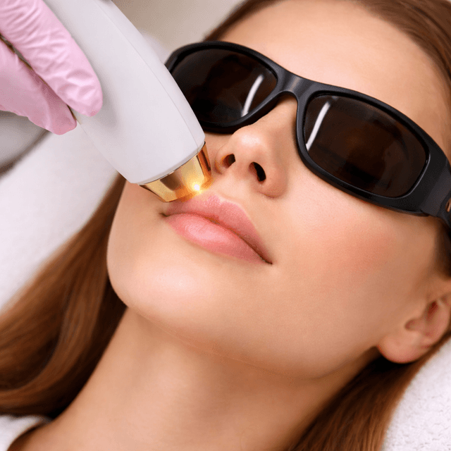 Depilación Láser en Bozo o Bigote at Universal Skin Care in Aguada, PR